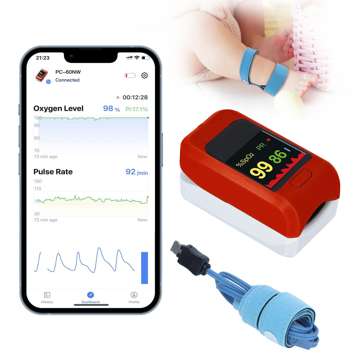 Baby Oxygen Monitor with Bluetooth App Baby Pulse Oximeter Tracks Babys Heart Rate Oxygen Level Baby Sleep Monitor Adjustable Foot Band for 0-36 Months Infant